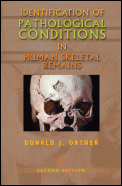 Identification of Pathological Conditions in Human Skeletal Remains (bog cover)