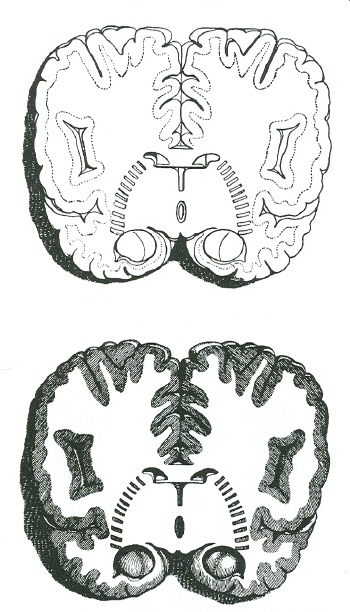 Tavle 3